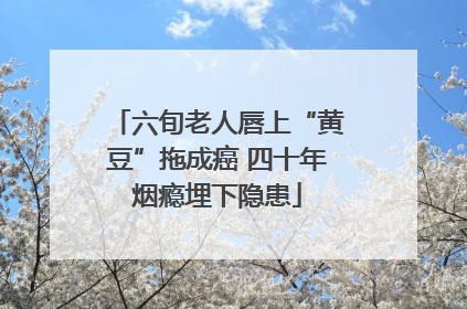 六旬老人唇上“黄豆”拖成癌 四十年烟瘾埋下隐患